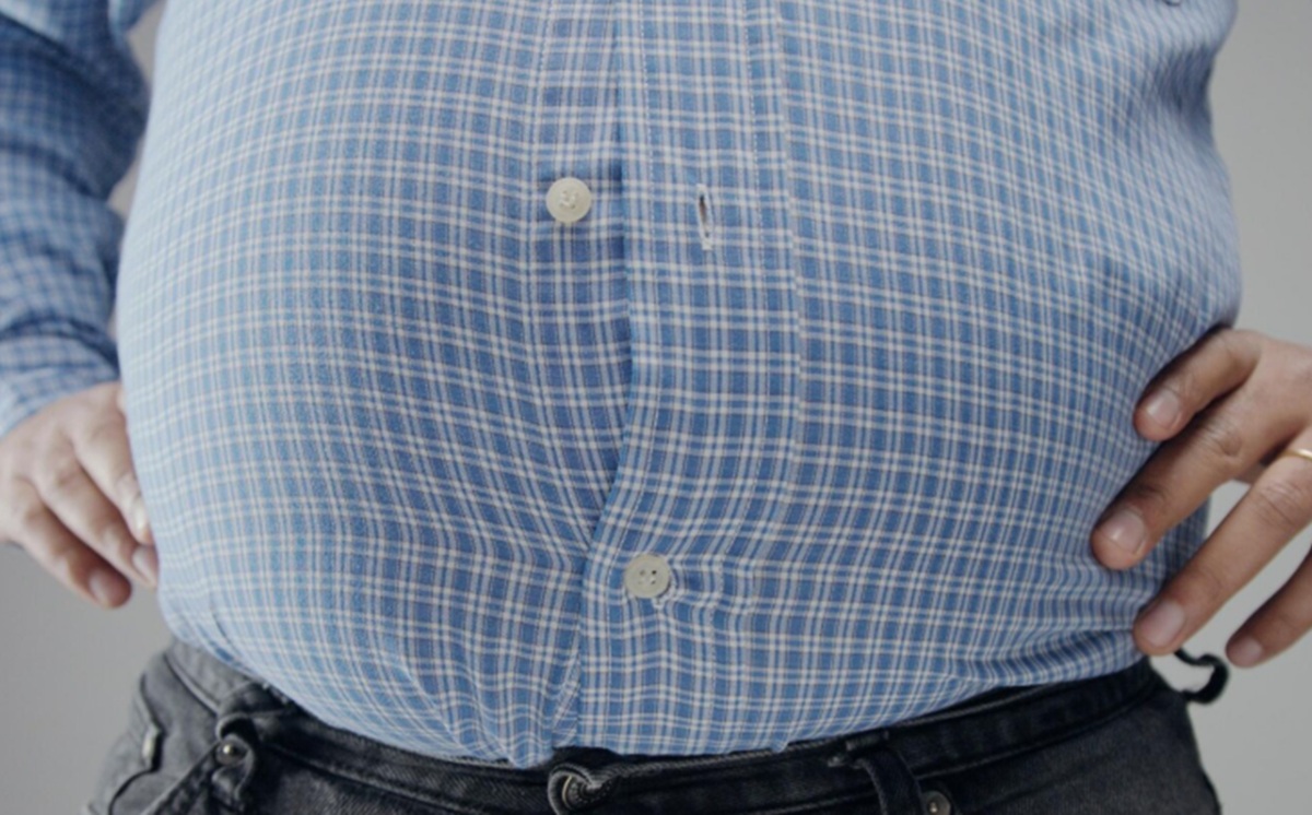 70 Persen Warga AS Masuk Kategori Obesitas Berisiko Tinggi